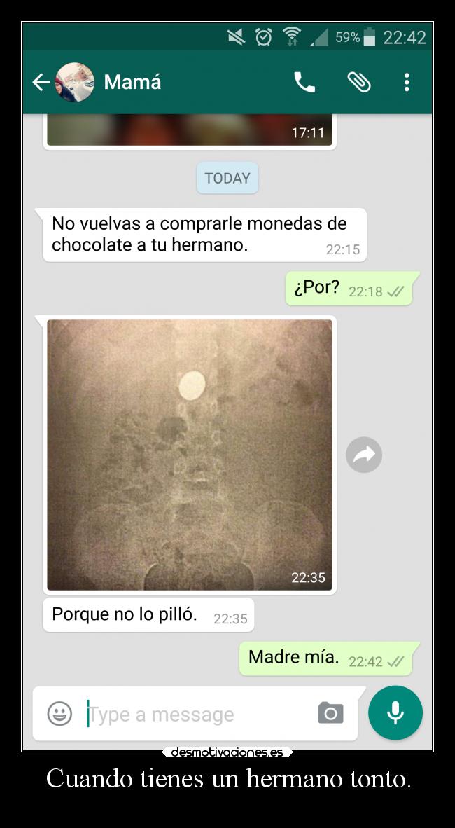 Cuando tienes un hermano tonto. - 