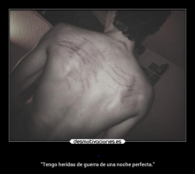 . - Tengo heridas de guerra de una noche perfecta.