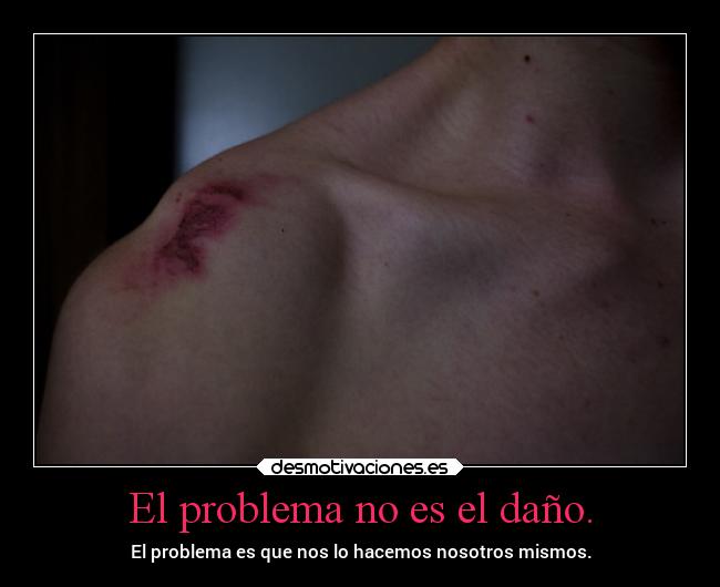 El problema no es el daño. - El problema es que nos lo hacemos nosotros mismos.