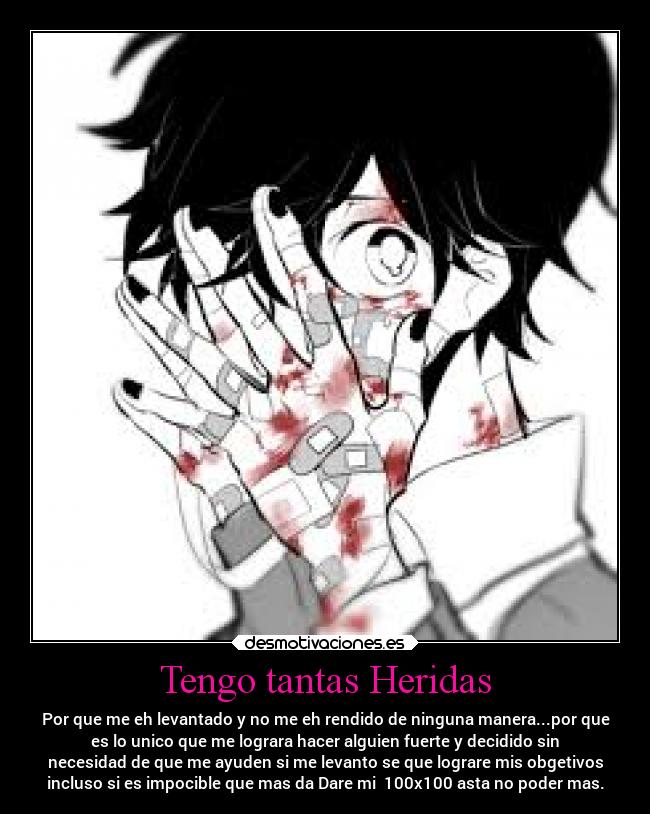 Tengo tantas Heridas - Por que me eh levantado y no me eh rendido de ninguna manera...por que
es lo unico que me lograra hacer alguien fuerte y decidido sin
necesidad de que me ayuden si me levanto se que lograre mis obgetivos
incluso si es impocible que mas da Dare mi  100x100 asta no poder mas.