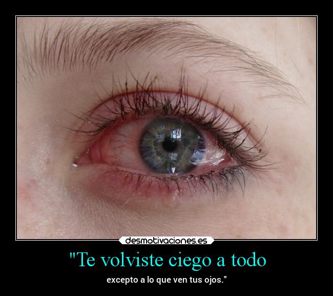 Te volviste ciego a todo - excepto a lo que ven tus ojos.
