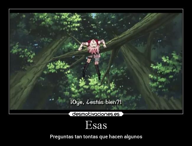 Esas - Preguntas tan tontas que hacen algunos