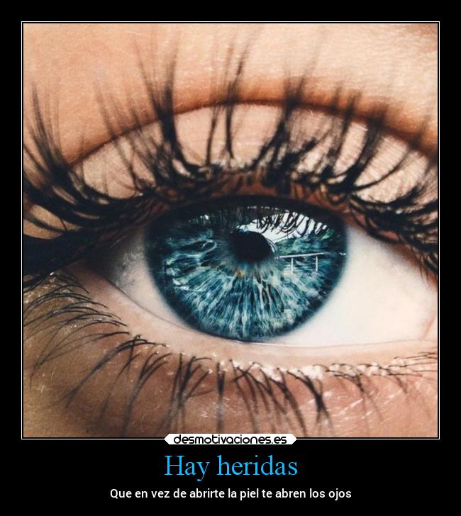 Hay heridas - Que en vez de abrirte la piel te abren los ojos
