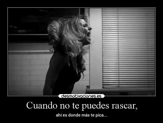 Cuando no te puedes rascar, - 