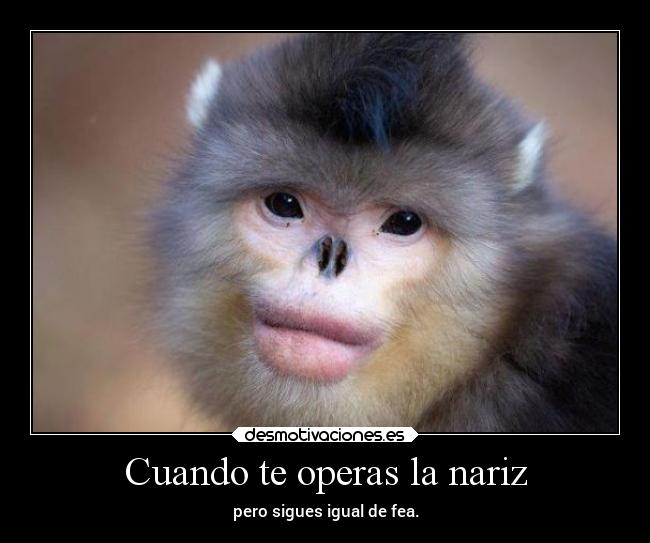 Cuando te operas la nariz -