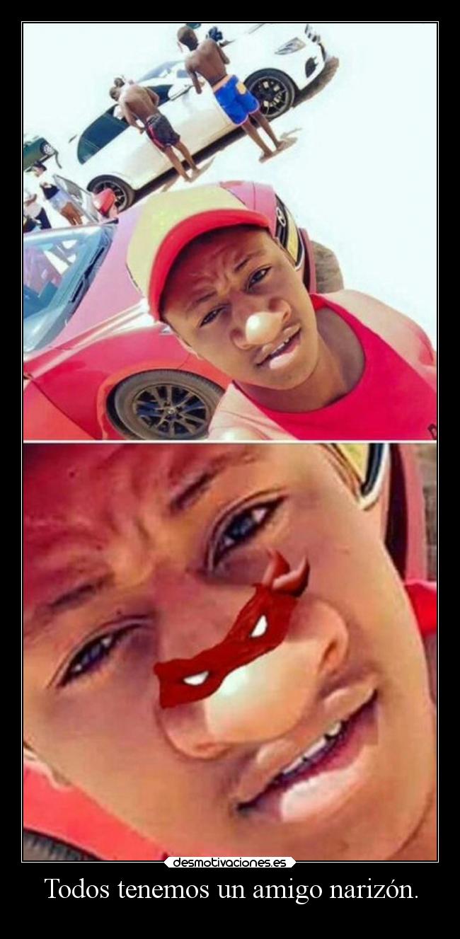 Todos tenemos un amigo narizón. -