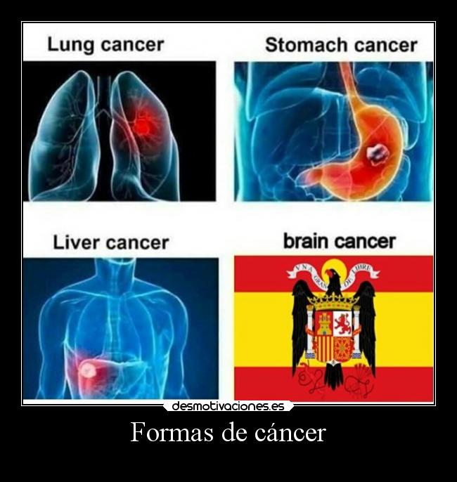 Formas de cáncer - 