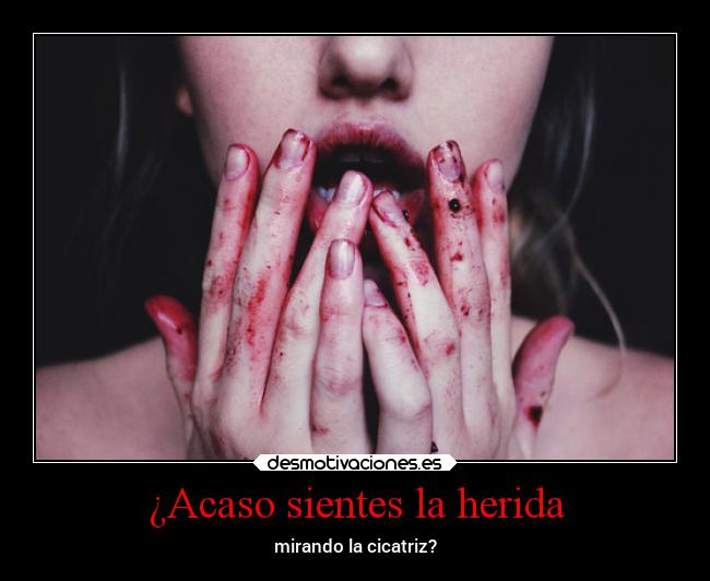 ¿Acaso sientes la herida - mirando la cicatriz?