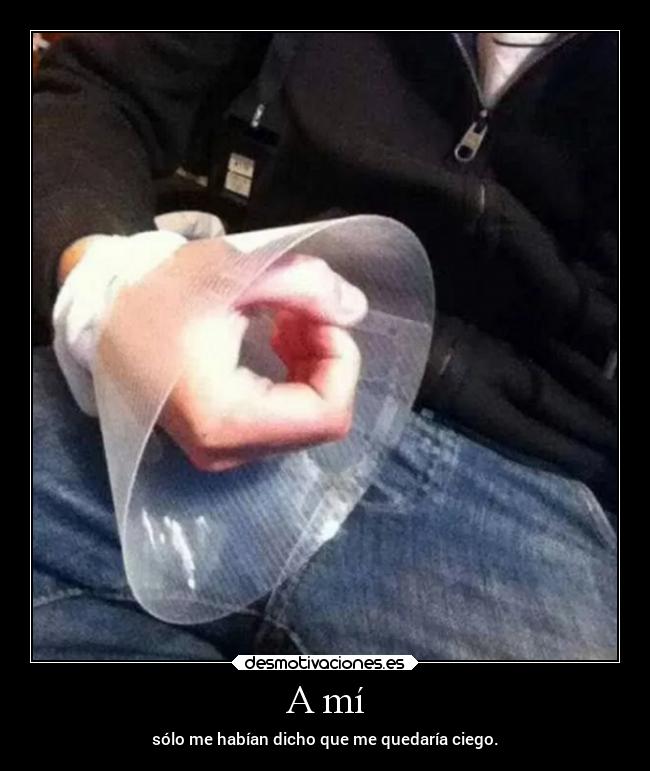 A mí - sólo me habían dicho que me quedaría ciego.
