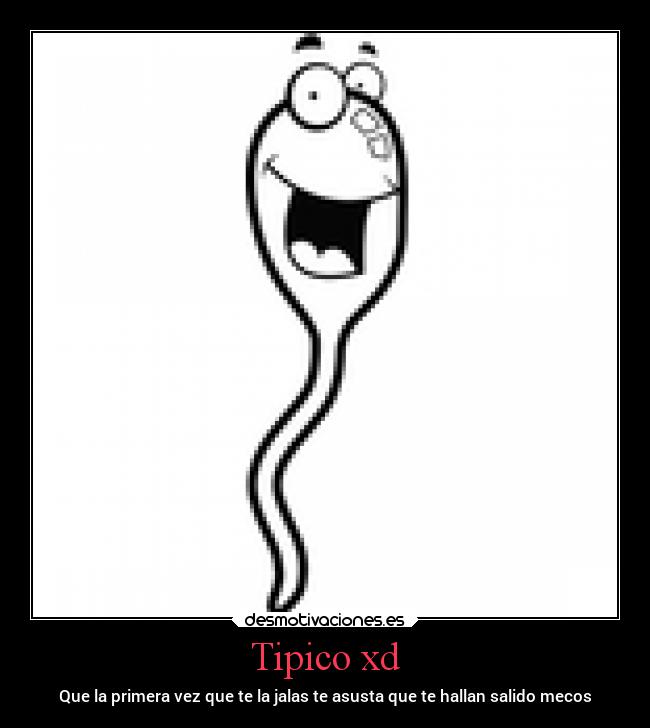 Tipico xd - 