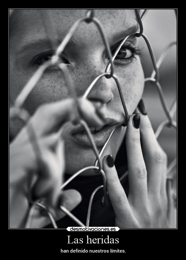 Las heridas - han definido nuestros límites.