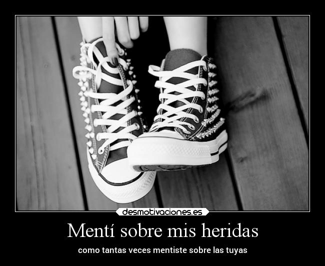 Mentí sobre mis heridas - como tantas veces mentiste sobre las tuyas