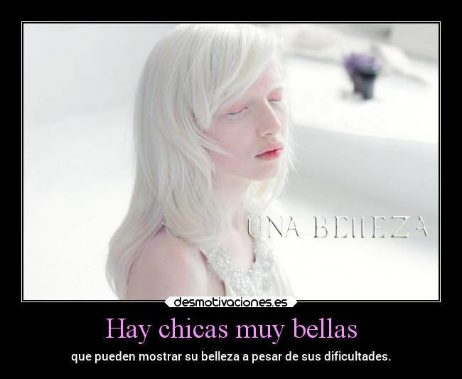Hay chicas muy bellas - que pueden mostrar su belleza a pesar de sus dificultades.