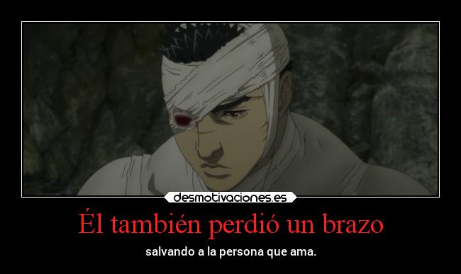 Él también perdió un brazo -