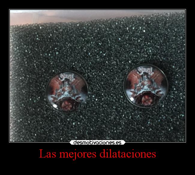 Las mejores dilataciones -