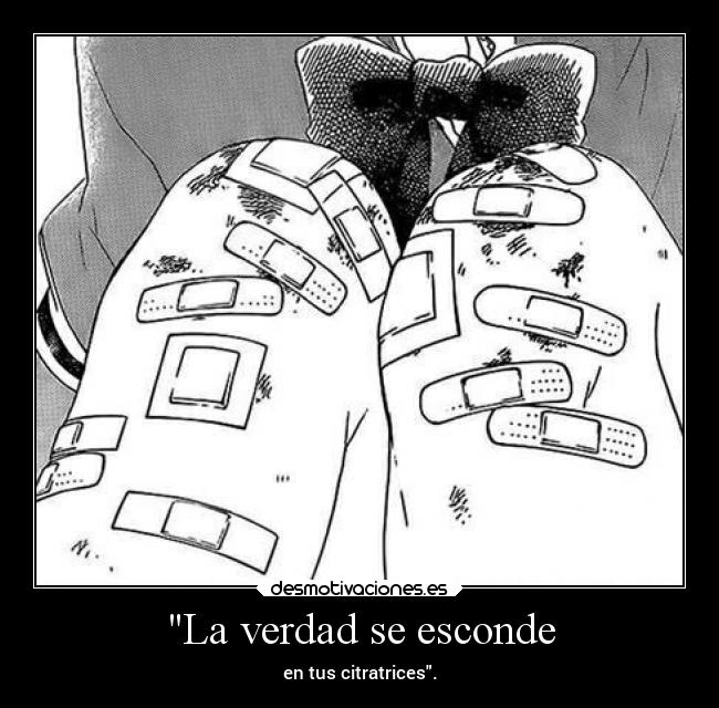 La verdad se esconde - en tus citratrices.