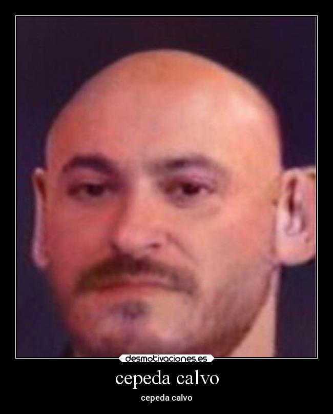 cepeda calvo - 