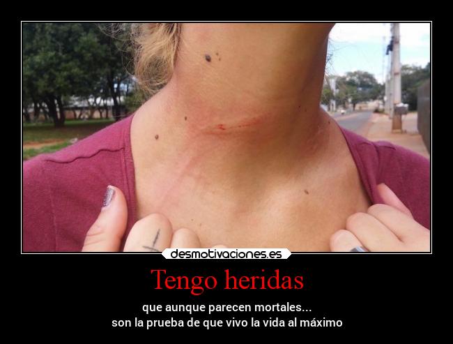 carteles dolor herida desmotivaciones