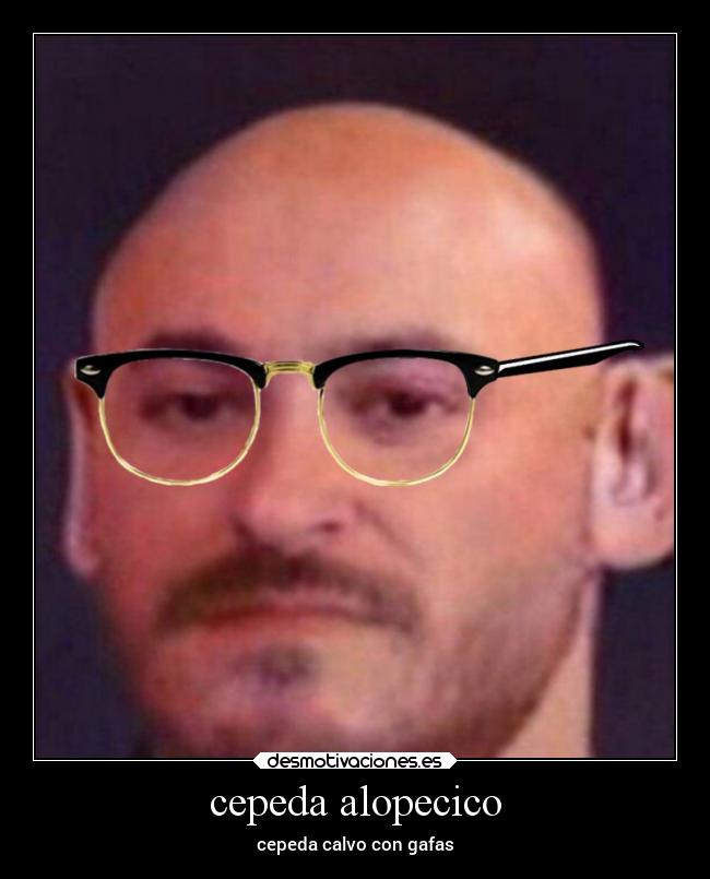 cepeda alopecico -