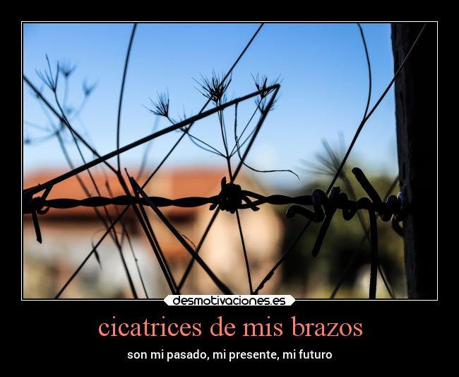 cicatrices de mis brazos - son mi pasado, mi presente, mi futuro