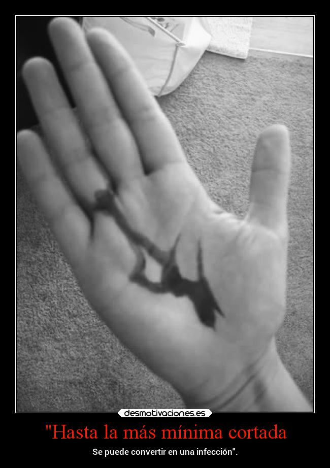 Hasta la más mínima cortada - Se puede convertir en una infección.