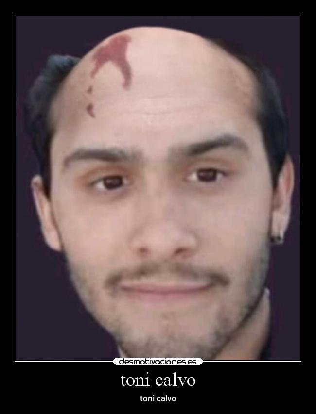 toni calvo - 