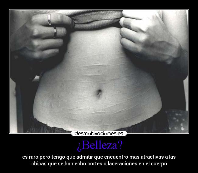 ¿Belleza? - es raro pero tengo que admitir que encuentro mas atractivas a las
chicas que se han echo cortes o laceraciones en el cuerpo