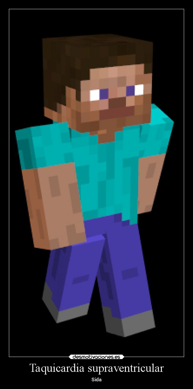 Taquicardia supraventricular - Sida