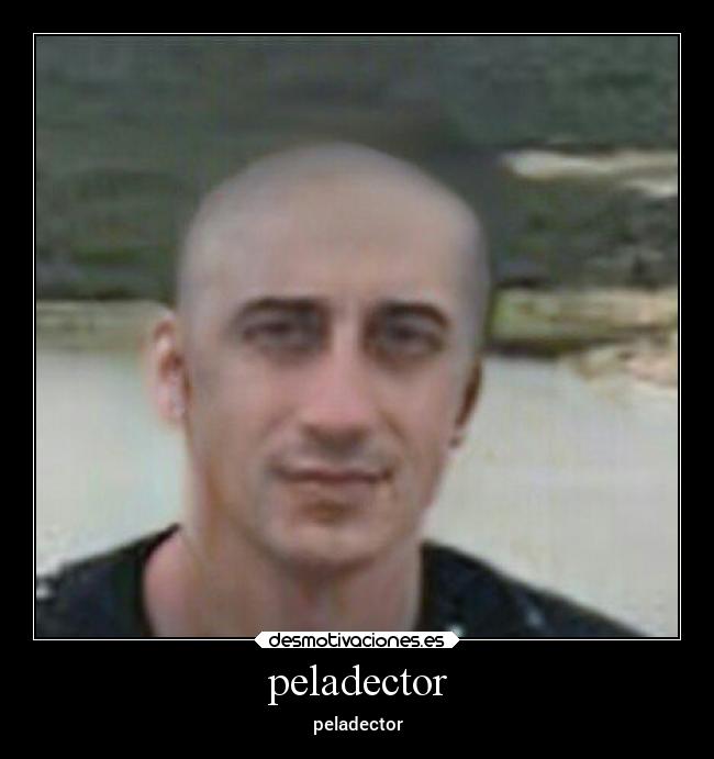peladector -