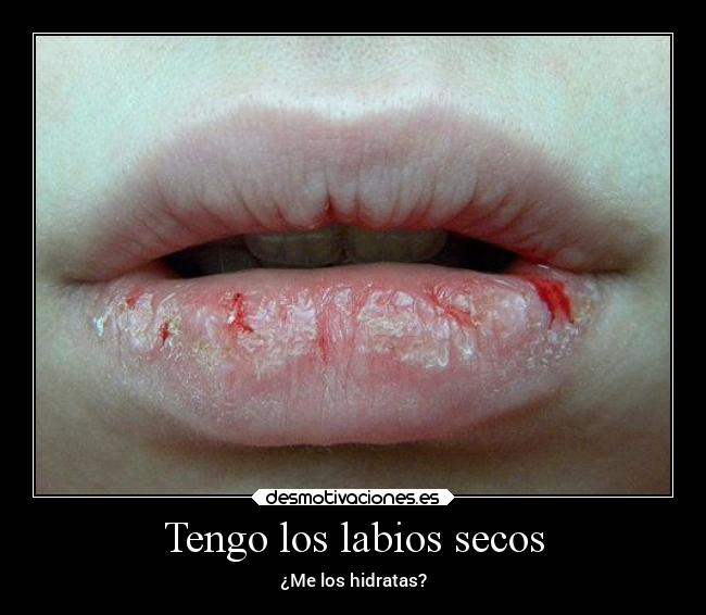 carteles besos tienes hambre comeme desmotivaciones