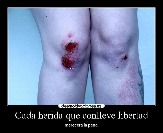 Cada herida que conlleve libertad - merecerá la pena.