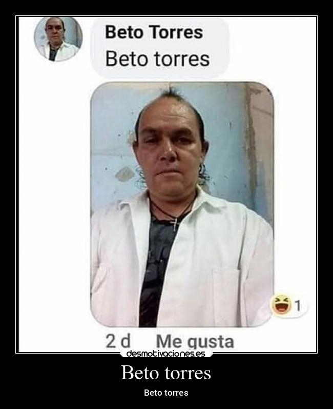 Beto torres - 