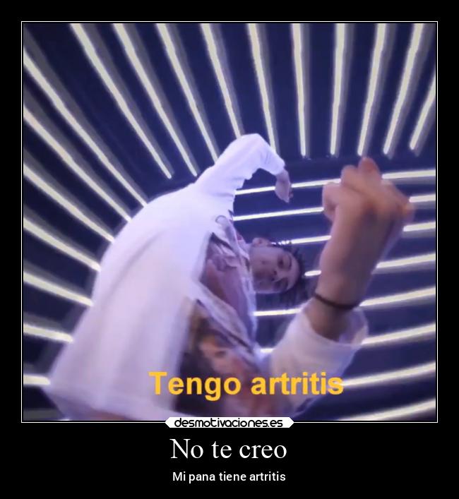 No te creo - Mi pana tiene artritis
