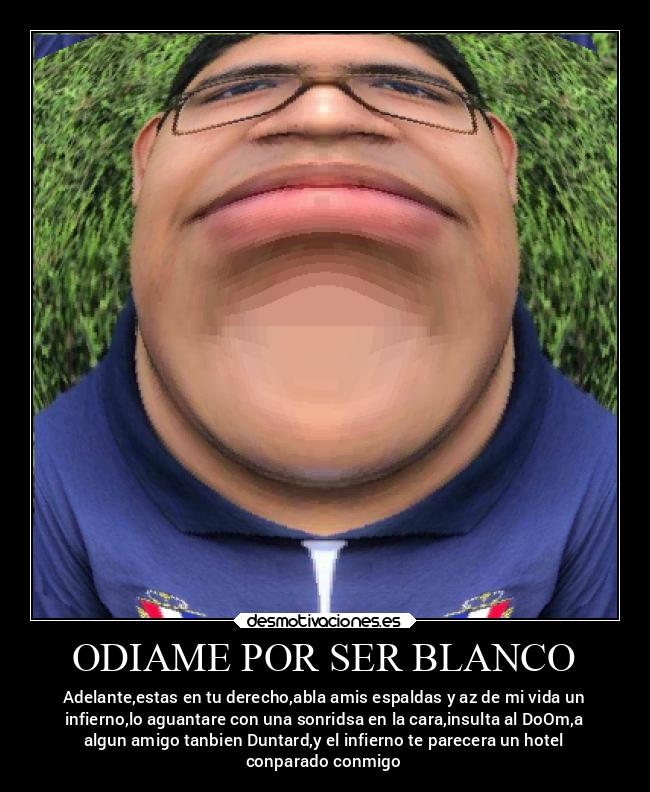 ODIAME POR SER BLANCO - 