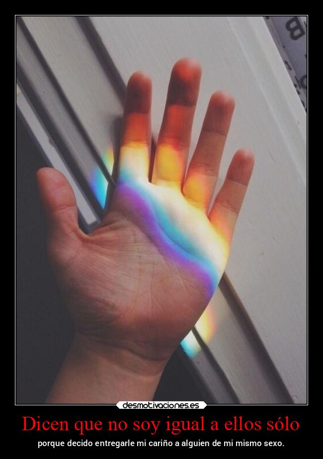 Dicen que no soy igual a ellos sólo -