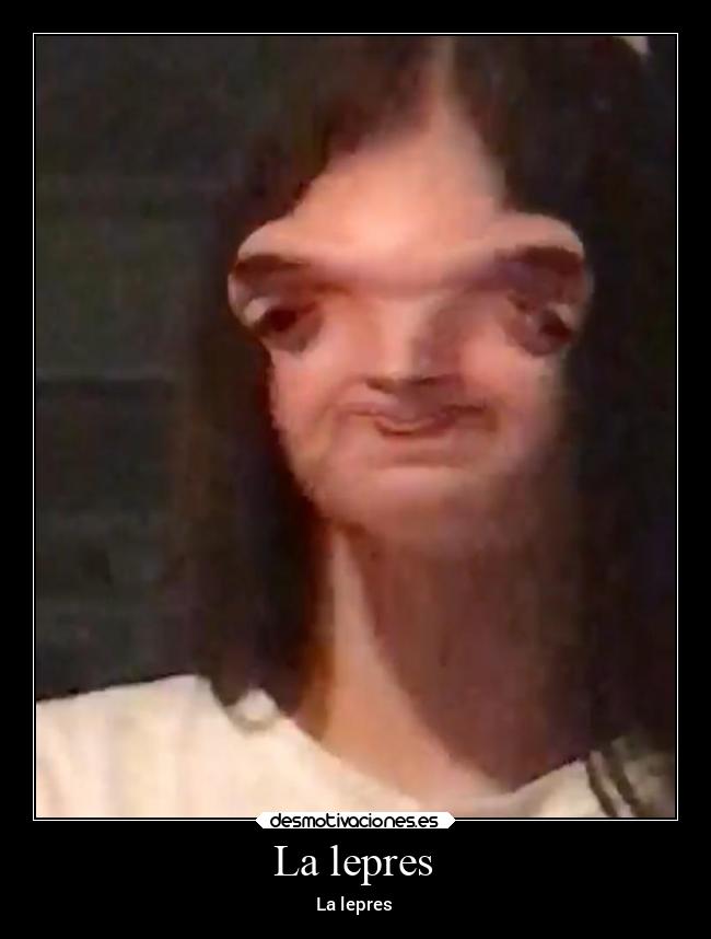 carteles abrazos lepres desmotivaciones