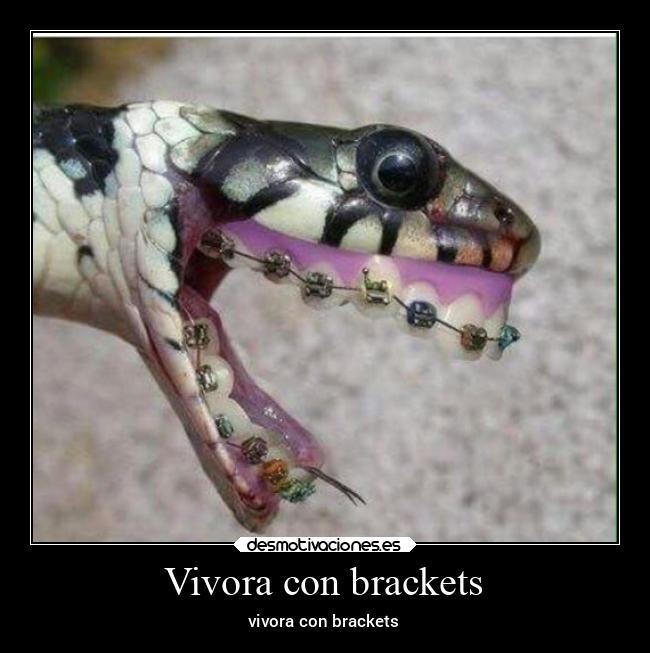 Vivora con brackets - vivora con brackets