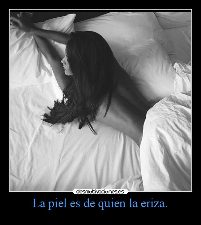 La piel es de quien la eriza. - 