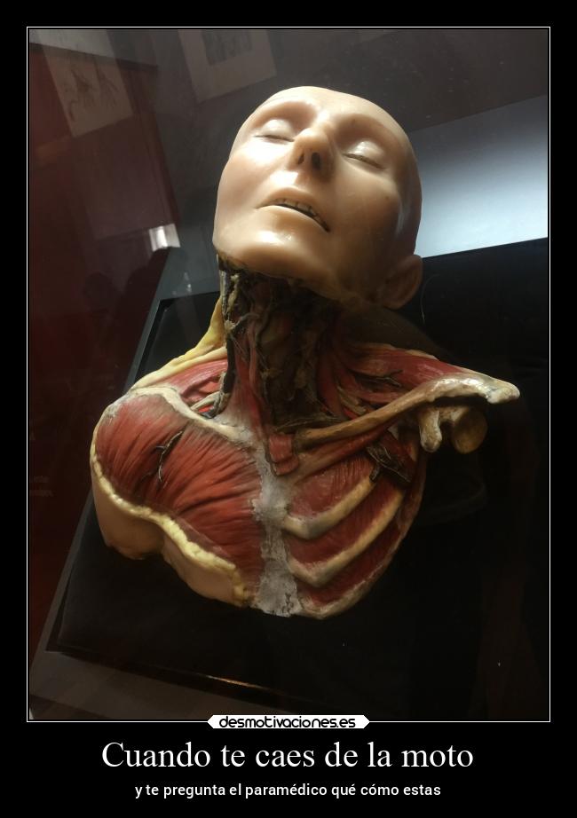 Cuando te caes de la moto -