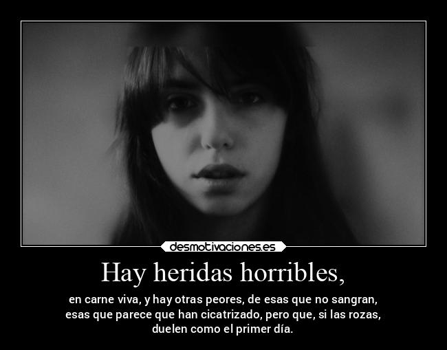 Hay heridas horribles, - en carne viva, y hay otras peores, de esas que no sangran,
esas que parece que han cicatrizado, pero que, si las rozas,
duelen como el primer día.