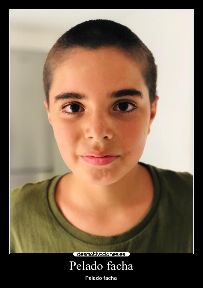 Pelado facha - 