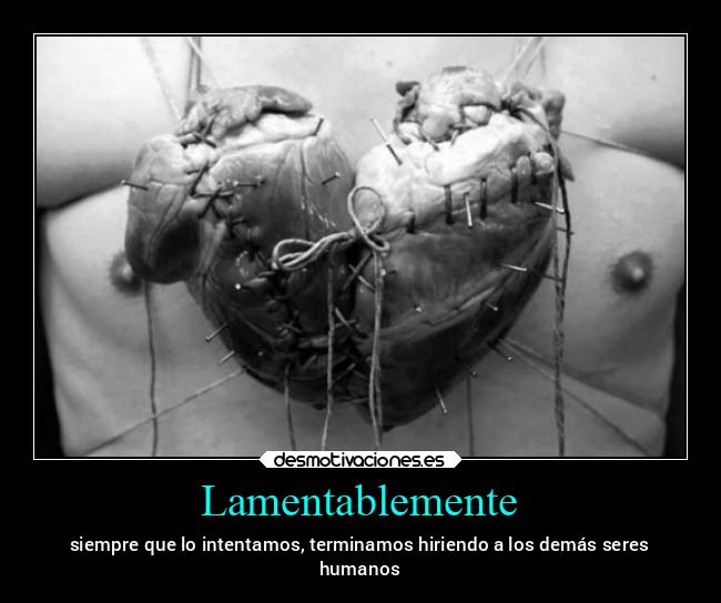 Lamentablemente - 