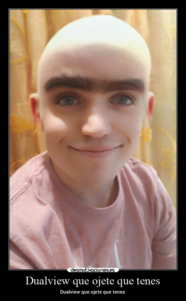 Dualview que ojete que tenes - Dualview que ojete que tenes