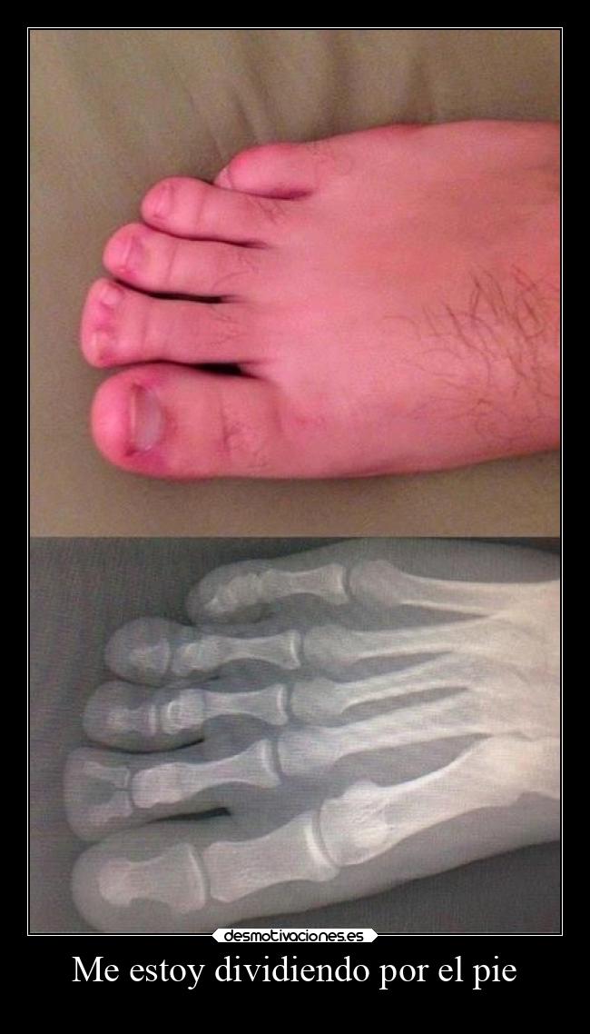 Me estoy dividiendo por el pie - 