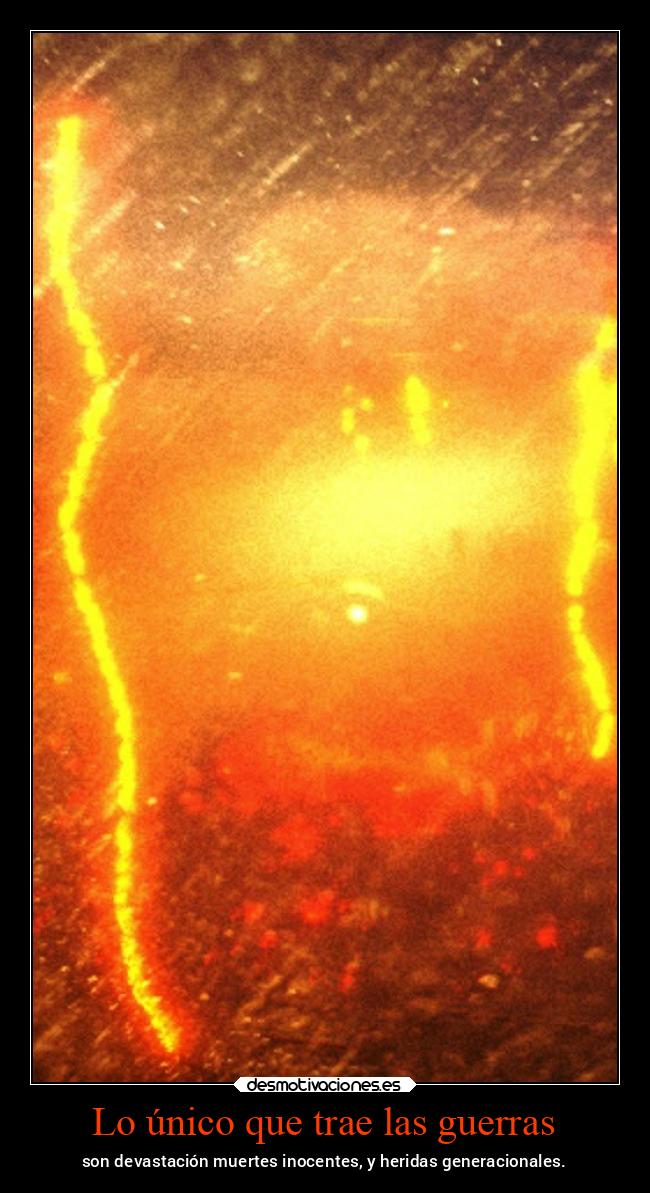 Lo único que trae las guerras - son devastación muertes inocentes, y heridas generacionales.