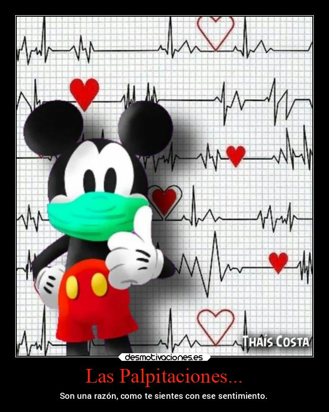 Las Palpitaciones... - Son una razón, como te sientes con ese sentimiento.