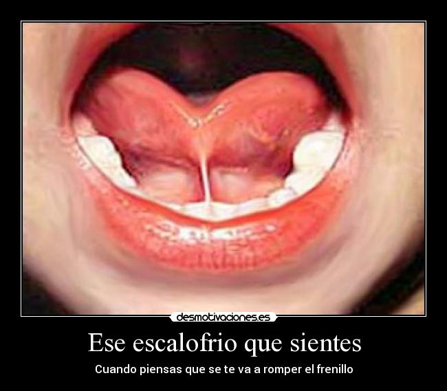 como se puede romper el frenillo del hombre