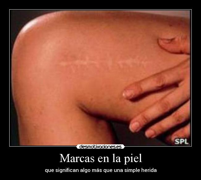 Marcas en la piel frases