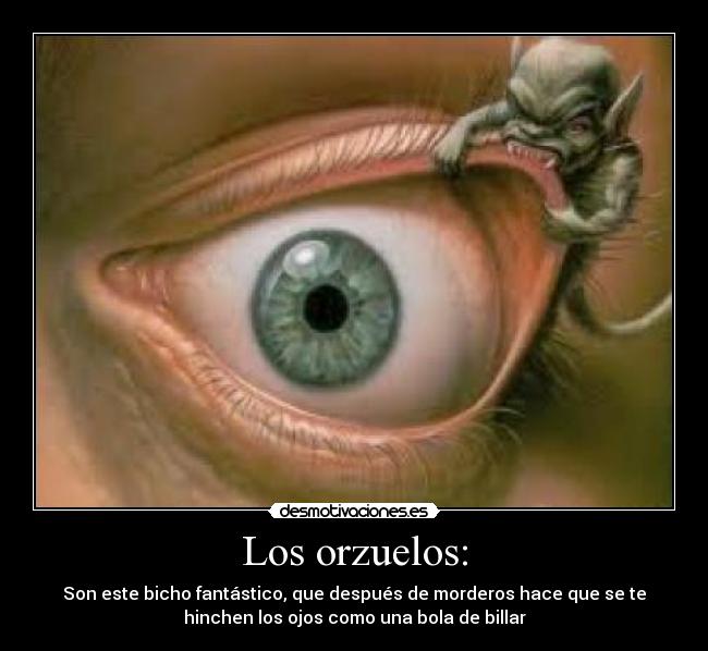 como curar un orzuelo con anillo de oro