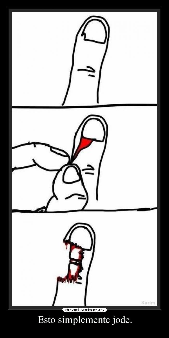 Смекалка. Не оторвать теперь. Не оторвать теперь. Не оторвать теперь. Надо позвонить маме и сказать где я.